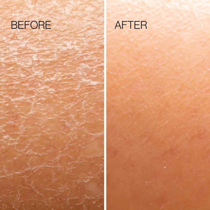 Esker | Body Plane Exfoliator Tool - Esker - Living with Ivey