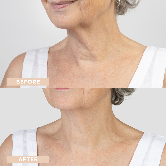 Neck + Décolleté Firming Cream - Day and Night